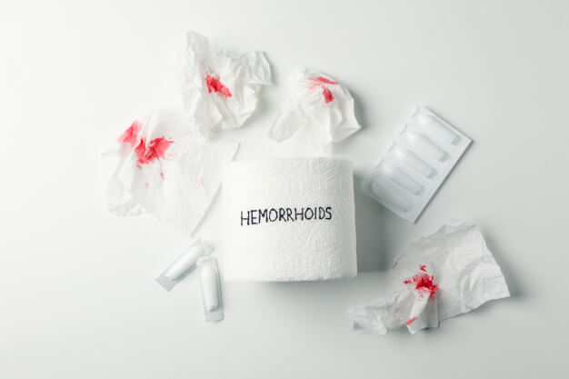 بواسیر چیست